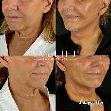 brushyourteeth #periodontist #implantdentistry #flosslikeaboss…