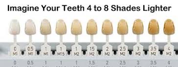 tooth color chart teeth whitening