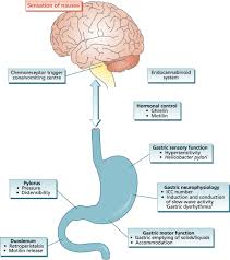 Image result for Chronic Functional Vomiting