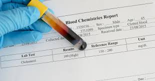 Maybe you would like to learn more about one of these? High Cholesterol Levels Causes Risk Factors Symptoms Treatments