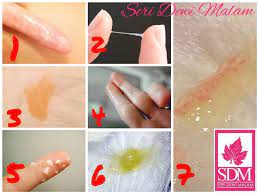 Maybe you would like to learn more about one of these? Alert Bahaya Pakar Sakit Puan Bersama Seri Dewi Malam Facebook