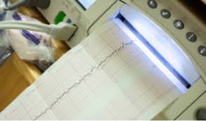 Bu test genellikle hamileliğin 32. Nst Nedir Nst Yorumlama Nasil Yapilir 1anne1bebek