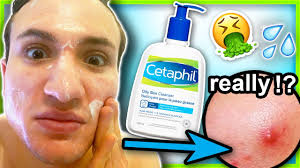 Mild enough to cleanse a baby's delicate skin. Cetaphil Oily Skin Cleanser Before And After Promotions