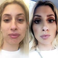 Stacey solomon shares update on plans for wedding to joe swash on itv's lorraine. Stacey Solomon Reveals How Different She Looks Before Make Up Including Period Skin And A Black Eye Daily Record