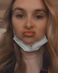 Can cold proof for 3 days before baking?