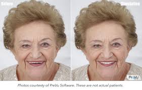 Feiler Dental Associates