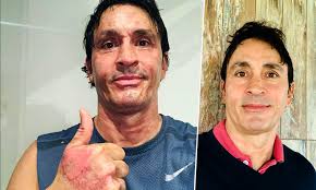 In 2005 he played the role of nicolás pacheco in amor en custodia next to osvaldo laport. El Estremecedor Relato De Sebastian Estevanez Del Feroz Accidente Que Le Quemo La Cara Y El Cuerpo No Soportaba El Dolor Revista Paparazzi