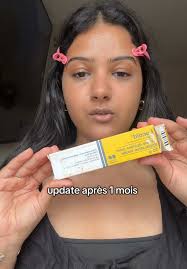 vous connaissez des dermatologues à Nice qui maitrise les peaux  mattes-noires svp et qui repond 🥲😂?