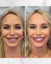 When Heather Ridgeway became “THE Heather Ridgeway.”