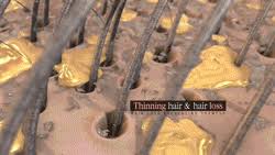 Hair Restore Biotin Hair Growth Serum Review Https Encrypted Tbn0 Gstatic Com Images Q Tbn 3aand9gcqrp1i4rjf50i9xj7svw8j 7qizijvoa Gkow Usqp Cau