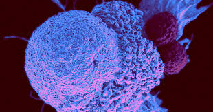 Overall, there was an increase in cancer incidence of almost 30% between 1973 and 2015. Severe Cancer Is On The Rise