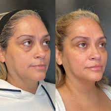 Dani Roberts, ARNP, CANS