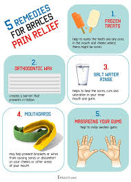 Everything You Need To Know About Rubber Bands For Braces
