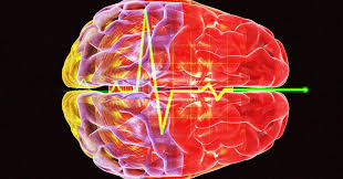 Scientists Recorded the Brain Activity of a Person as They Died ...
