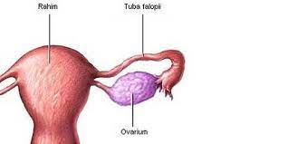 7 Penyebab Kista Rahim Patut Diwaspadai Salah Satunya Konsumsi Obat Subur Merdeka Com