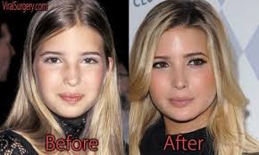 Pin On Viral Celebrity Plastic Surgeries