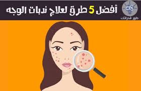 Pin On اهم المواضيع من موقع طور قدراتك