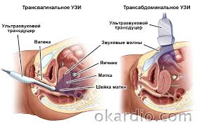 когда начинает биться сердце у ребенка в утробе матери Udary Serdca V Utrobe Ispolzuya Fetalnyj Doppler Chto Delat Pri Narushenii Normy