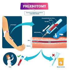 The department of illinois veterans affairs lists american medical technologists for phlebotomy certification illinois. Master S Guide To Venipuncture Pro Tips For Performing Venipuncture Unitek College