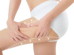 Uyluk Germe Ameliyati Ust Bacak Gerdirme Estetigi Fiyatlari Ankara