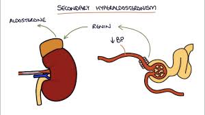 Image result for Hyperaldosteronism