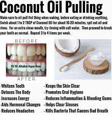Trying This As We Speak Beautytipsbody Teeth Health Health Remedies Natural Health