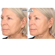 NassifMD Even, Correct, Renew & Hydrate Nightly 2-piece Set