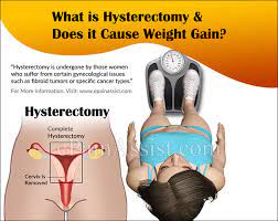 They may be used alone or in combination depending on tumor volume, spread pattern, and figo staging. Does Hysterectomy Cause Weight Gain Know The Causes Of Weight Gain After Hysterectomy How To Prevent It