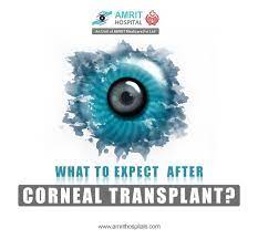 Pin On Best Eye Hospital In Chennai