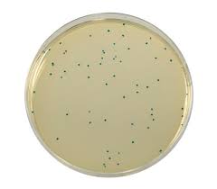 Image result for Enterococcus