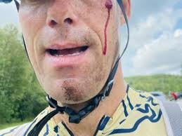 Accident tales from Truro bikers: Part 2