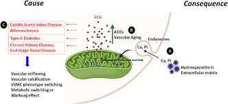 Amazing thani by guruvayur dorai on mridangam and g.harishankar on khanjira vocal: Frontiers Mitochondrial Dysfunction Cause Or Consequence Of Vascular Calcification Cell And Developmental Biology