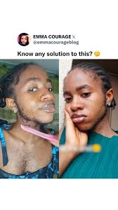 She decided to leave my beards for just one month!!! 🫵 📹VC:  TT/Hairychinny #EmmacourageBlog #Trendingvideo