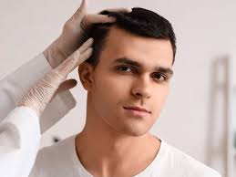 Long Hair FUE vs. Geleneksel FUE: Hangisi Sizin İçin Uygun?