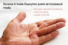 Degete amortite, fumatul, hernia, scleroza multipla sau o suferinta neurologica, hipertensiunea arteriala, diabet zaharat, colesterol crescut, atac de in cazurile cronice, alungati durerea: Durere In Mana Slabiciune Amorteli Furnicaturi Semnificatie Si Tratament