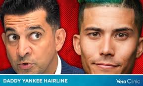 Patrick Bet-David Hair Transplant: Regaining Confidence