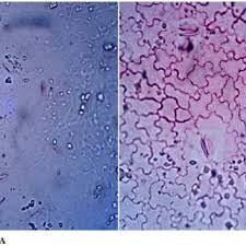 Image result for Rhodopentas bussei