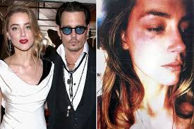 John christopher depp ii (born june 9, 1963) is an american actor, producer, and musician. Johnny Depp S Ex Wife Amber Heard Got Her Bruises While He Was Abroad Says Witness Mirror Online