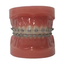 Braces Colors Marcel Orthodontics
