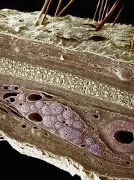 Photographic Print Skin Cross Section Showing The Epidermis Dermis Perichondrium Elastic Microscopic Photography Scanning Electron Micrograph Microscopic