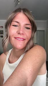 Sommersprossenliebe 🤍 #freckleslove #goodvibesonly #tattooaufsommers...