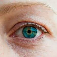 Ahora un estudio propone una clasificación pionera del color de los ojos en españa y abre nuevos caminos en el. 11 Ideas De Cataratas En Los Ojos Cataratas Ojos Cataratas Ojos
