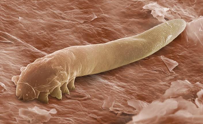 Our Parasites And Vermin Reveal Secrets Of Human History | WAMC