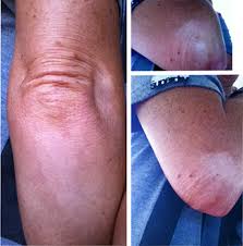 Uneven/bad/unwanted tans are the worst! Spray Tan Disasters