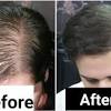 Pumpkin seed oil is said to both prevent hair loss and promote hair regrowth by taming inflammation, decreasing the constriction of blood vessels in the scalp, and replacing the elements necessary for hair regrowth. Https Encrypted Tbn0 Gstatic Com Images Q Tbn And9gctlxddxhasul Wevkyhpkvyjjp7wru0fhlxpuufognotdsqvznn Usqp Cau