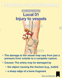 Image result for Fracture Complication