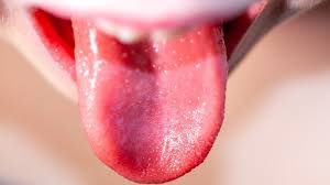 Image result for Puchýře na jazyku