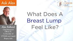 13 ﻿ that said, it tends to push on nearby structures more rapidly than a tumor would in most women. What Does A Breast Lump Feel Like Youtube