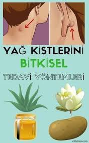 yag kistlerini evde tedavi etmeniz icin 10 dogal oneri herboloji yag saglik