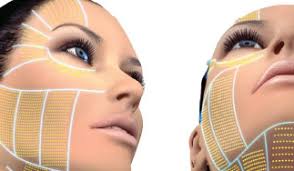 Nov 11, 2020 · ultherapy is a noninvasive skin tightening procedure. Ulthera Or Ultherapy For Skin Tightening And Lifting
